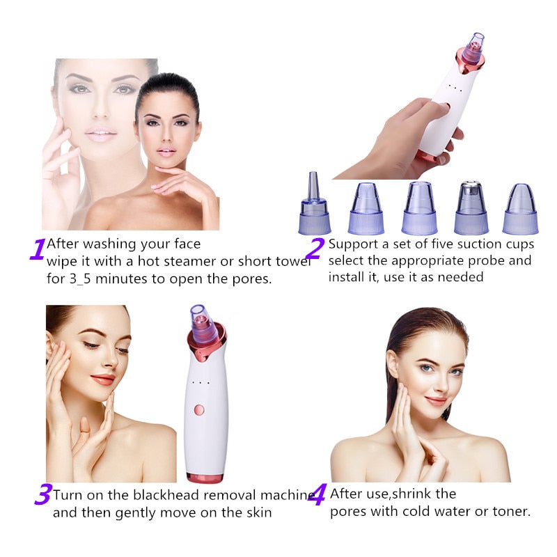 Acne Vacuum-Suction Cleaning Beauty Skin Care Tool