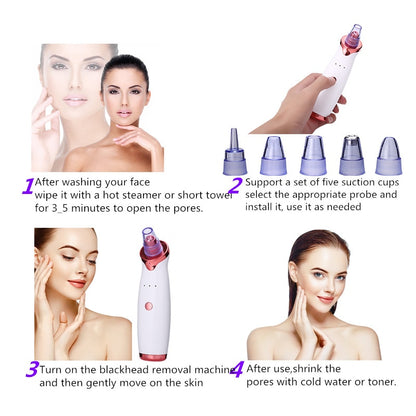Acne Vacuum-Suction Cleaning Beauty Skin Care Tool